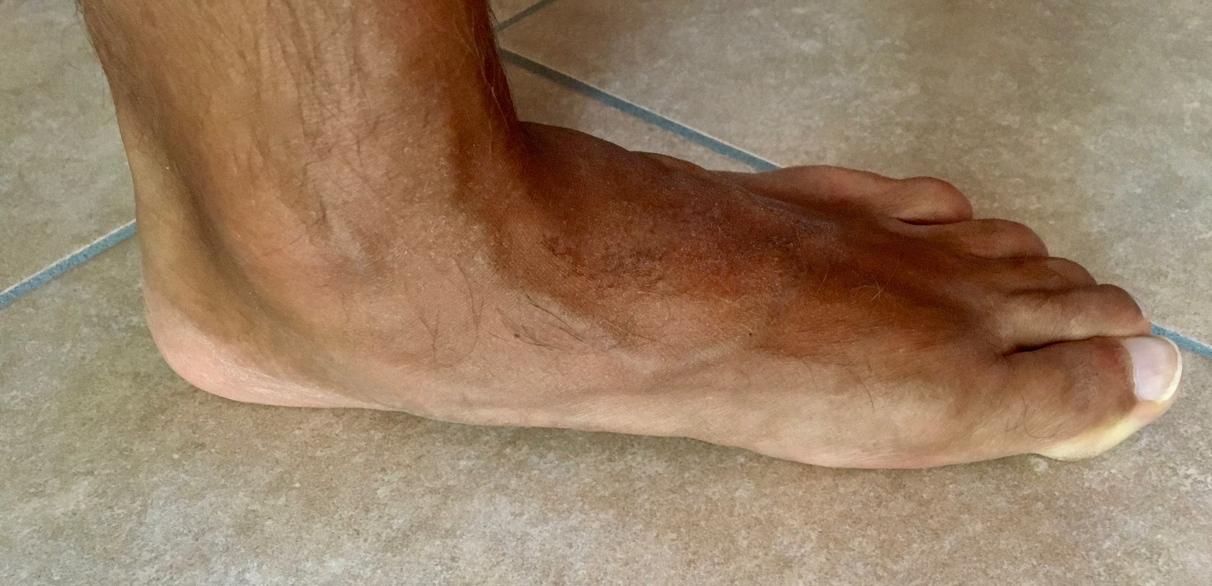 scarpe da calcio per piede a pianta larga